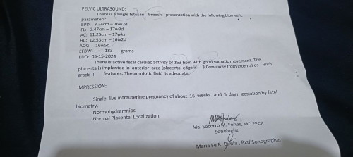 ano sa palagay nyu mga mi normal naba ang placenta ko