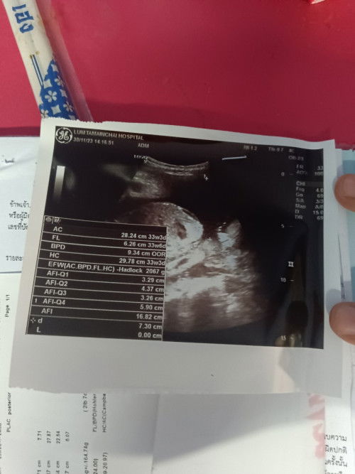 สอบถามแม่แต่ละบ้าน