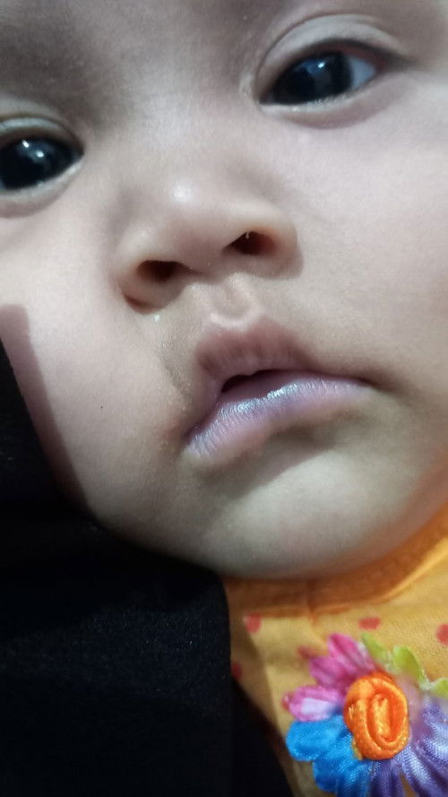 Bibir hitam tiba tiba