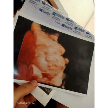 Apakah ada yg sama seperti sy bun ? Mlas mandi🤭 adasih mandi , tapi gak Kya biasa ny😁