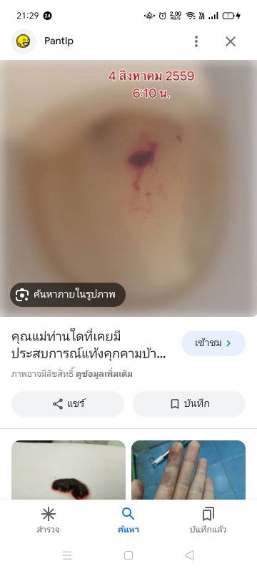 แม่ๆบ้านไหนตั้งครรภ์แล้วเปนลิ่มเลือดคล้ายประจำเดือนบ้างค่ะ แม่บ้านนี้ไปเฉี่ยวเจอวันนี้ เปนลิ่มเล็กๆ