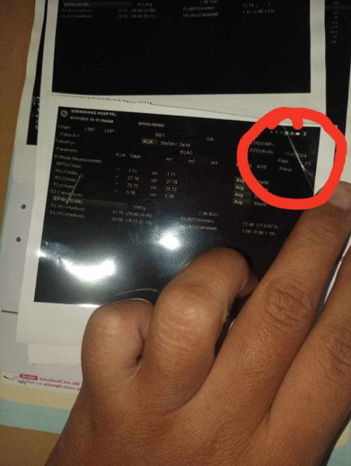 สอบถามแต่ล่ะใบซาว ทำไมวันไม่เหมือนกัน อีกใบ22/01/67 อีกใบ11/01/66
แบบนี้จะรู้ได้ไง