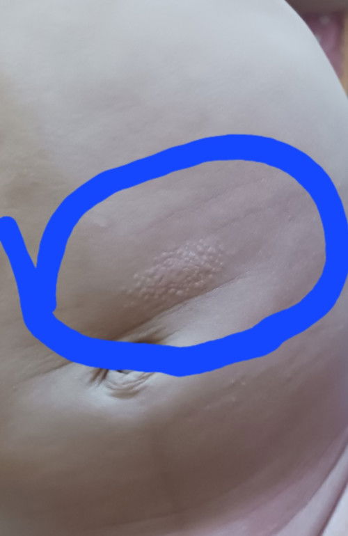 Mga mi, ano kaya to sa 2 months old baby ko? At anong pwedeng gamot?