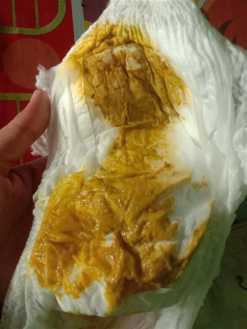 Feses bayi berlendir