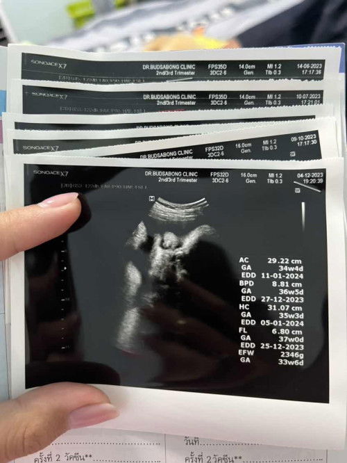 ช่วยดูให้หน่อยค่ะว่ามันคือจมูกหรือจูน้อง