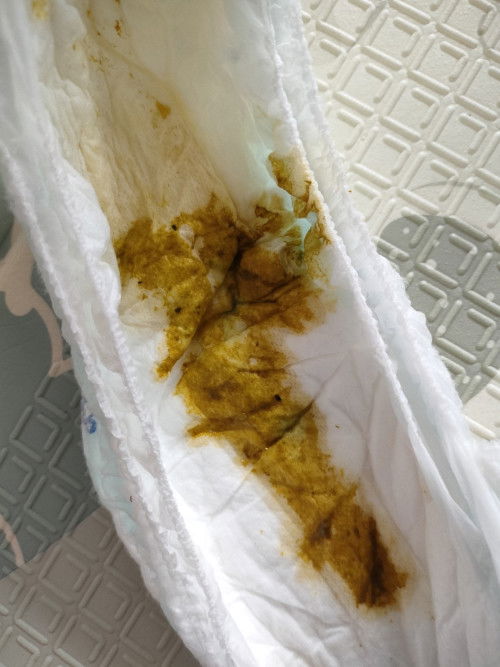 apakah ini tanda diare?