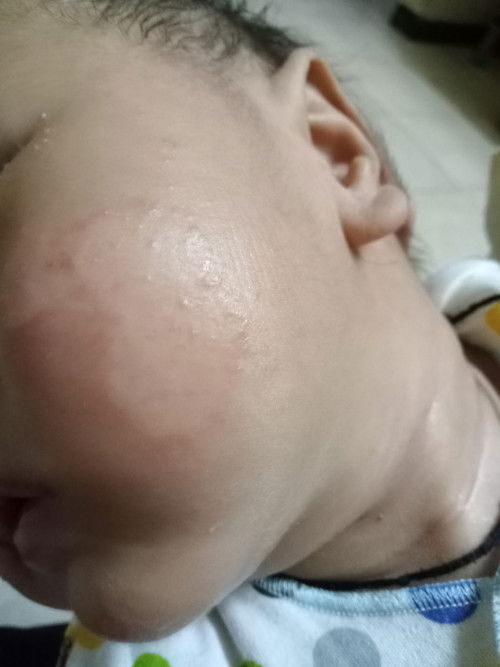 Rekomend salep yang mujarab