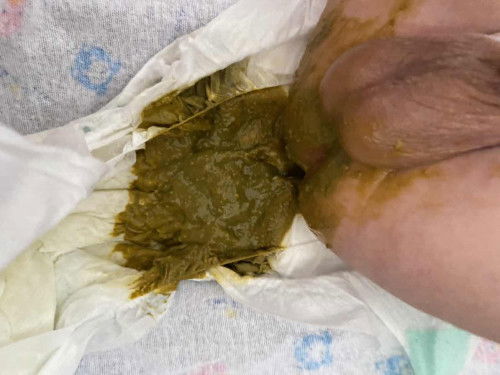 น้องได้1เดือน8วันกินนมผง