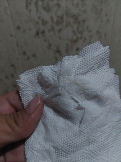 มูกใสหรือตกขาว