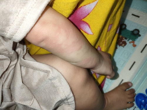 Ada yang mengalami ini kah?