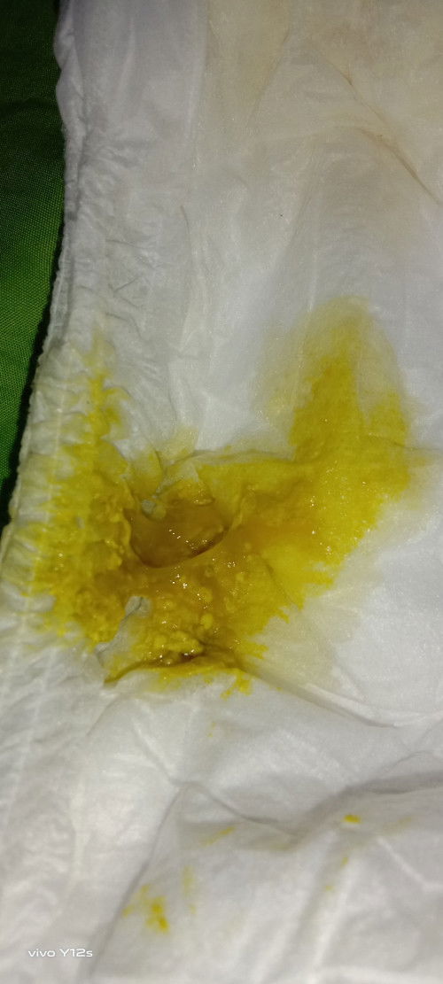 Mau nanya Bun tolong di jwb yah 😭