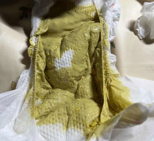 Baby 2bulan minum susu lactogen : najis hijau kekuningan