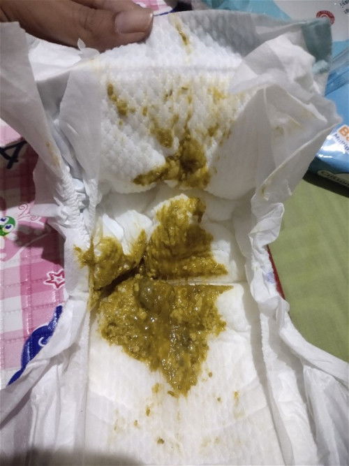 Feses bayi berlendir dan kuning kehijauan