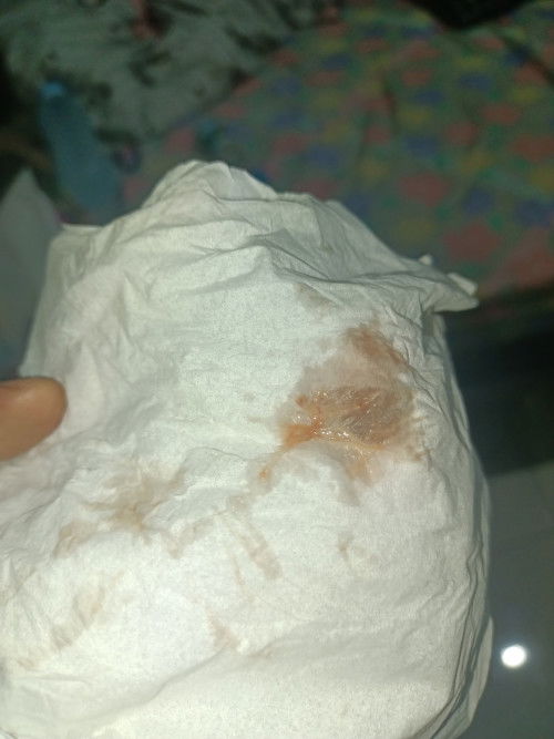 Flek coklat di usia kehamilan 7minggu apakah aman?