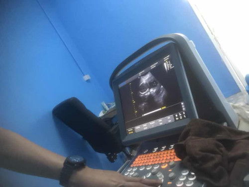 แม่ๆช่วยดูหน่อยคะว่าน้องเป็นผู้หญิงหรือผู้ชาย🥰