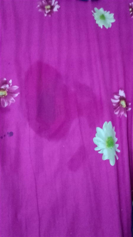 Air ketuban rembes/pecah
Hpl 8 Desember