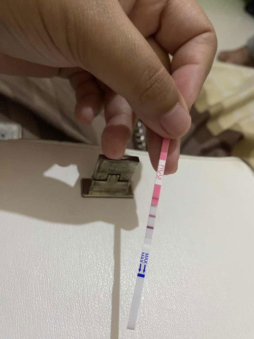 Masih percaya 1 dokter apa cari opini di dokter lain kalo spt ini bun