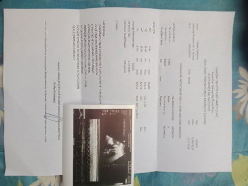 34weeks breech position