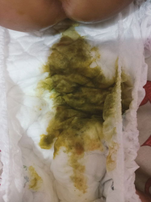 Bab bayi lebih sering