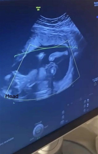 Gender Guesses??