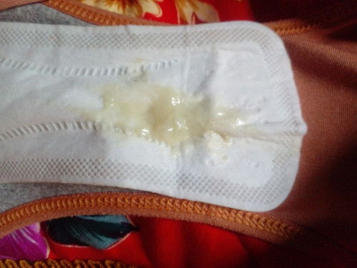 ni keputihan ke mucus plug ??