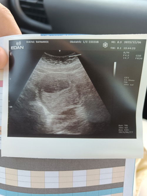 ซาวด์เจอแต่ถุง