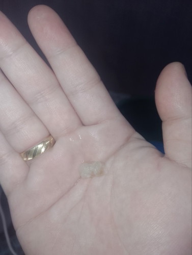 Mucus plug po ba ito?