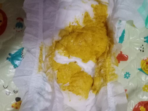 สอบถามแม่ๆค่ะ