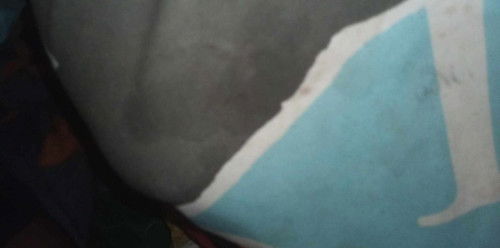 37+2สัปดาห์ มีนํ้านมไหล
แม่บ้านนี้มีน้ำนมไหลเเสดงว่าใกล้คลอดใช้ไหมค่ะ