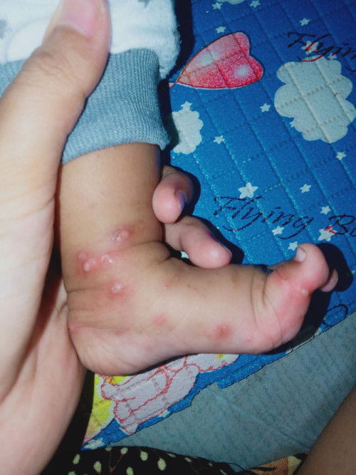 Solusinya apa yaa bun ?