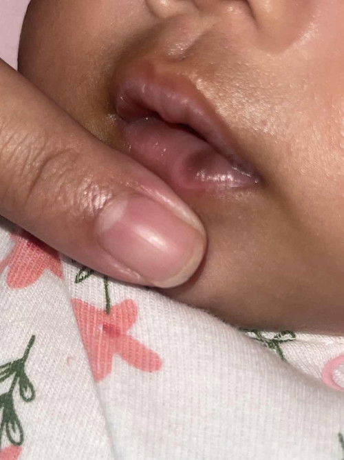 มีใครเคยเป็นมั้ยคะ น้องอายุ1เดือนปากดำเป็นจุดๆ พึ่งชัดเมื่อ3วันที่แล้ว  ตอนเกิดปากแดงชมพูมาก