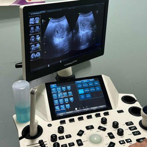 เจอน้องกันตอนกี่วีคหรอคะแม่ๆ