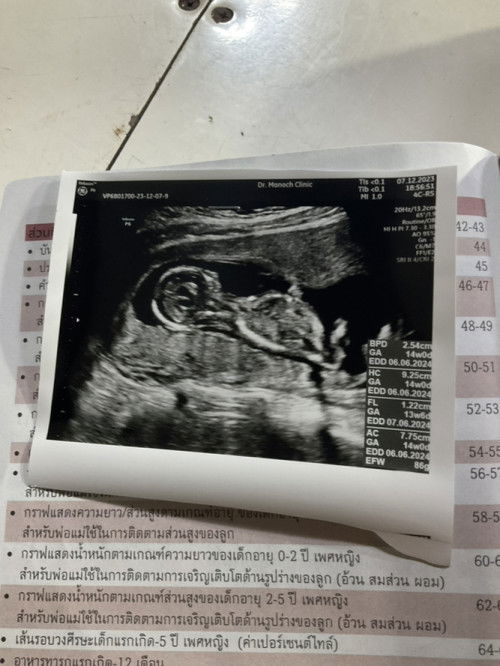 รู้ไหมว่าเพศอะไร