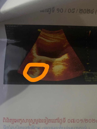 สับสนมากค่ะ ว่าทารกควรอยู่ตรงไหน เหมือนไม่ได้อยู่ในโพรง ดูไม่ออก