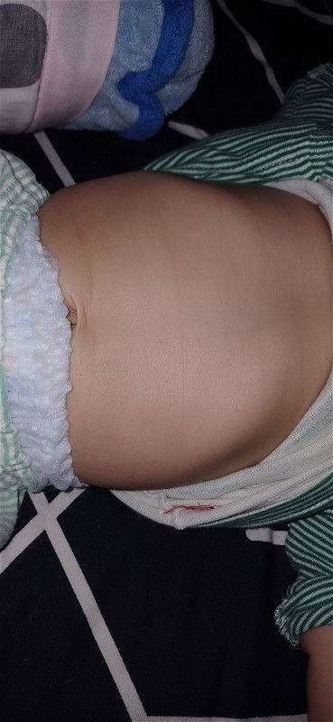 Tulang rusuk menonjol