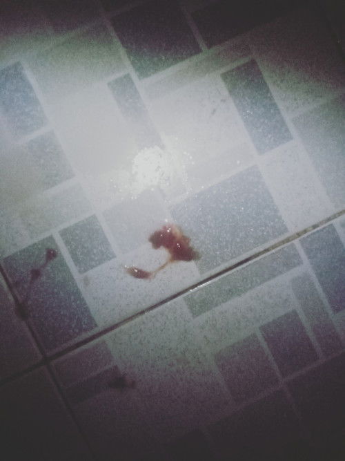 bầu 37 tuần cho em hỏi bị vay có sao Hông bị ra nhiều nữa