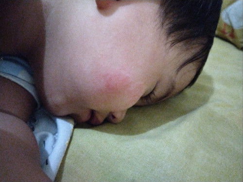 Bayi 4 bulan tidak buang air kecil