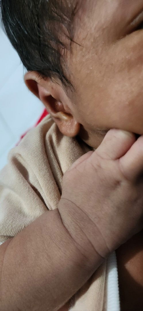 Warna kulit wajah dan badan tidak sama