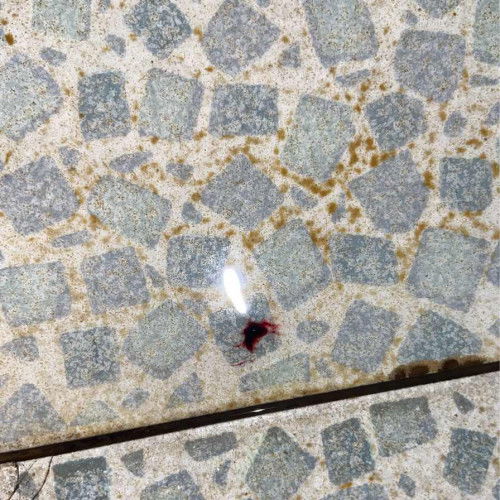 เลือดออกตอนท้อง10สัปดาห์