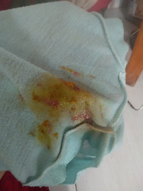 Pup berlendir dan berdarah