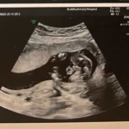 ฝากแม่ๆช่วยดูหน่อยค่ะ