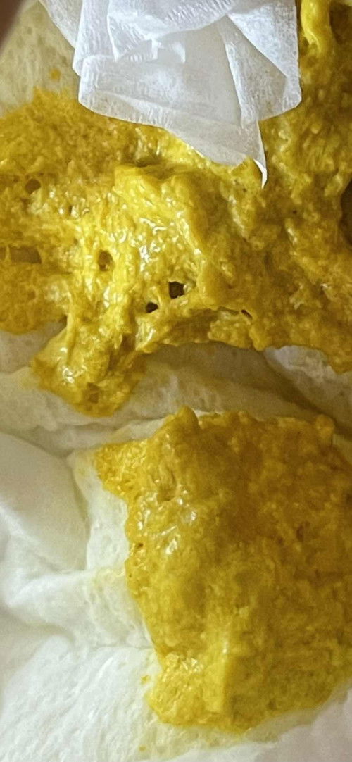 Yang jijikan tolong skip/Pup bayi usia 2 bln