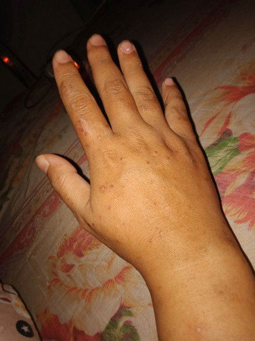 Gatal di usia kehamilan 34