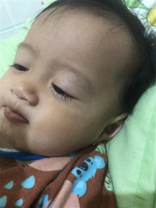 Putih di pipi