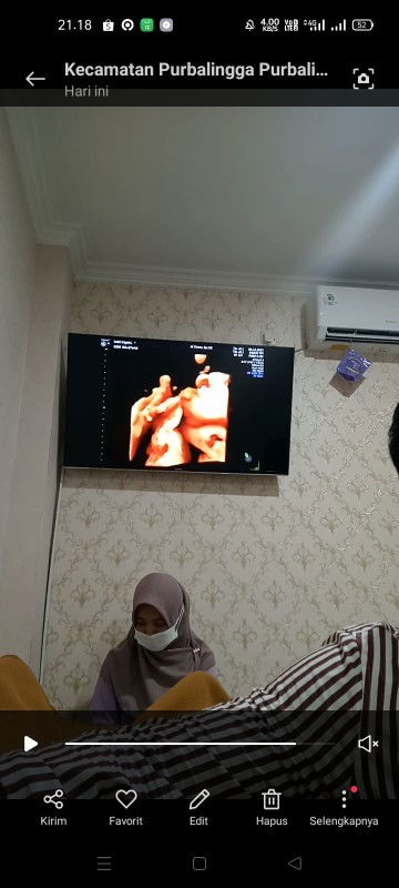 Kehamilan 27 weeks 5 day USG 4D