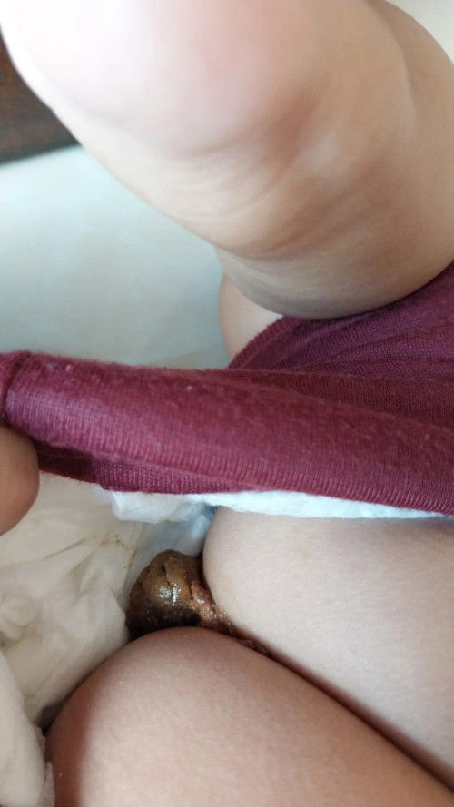 Ini sembelit atau tidak ya?