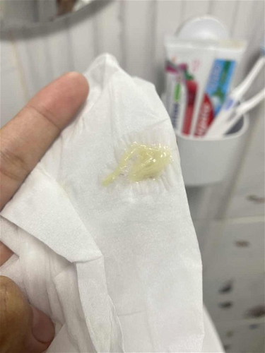 มูกแบบนี้คืออะไรคะ