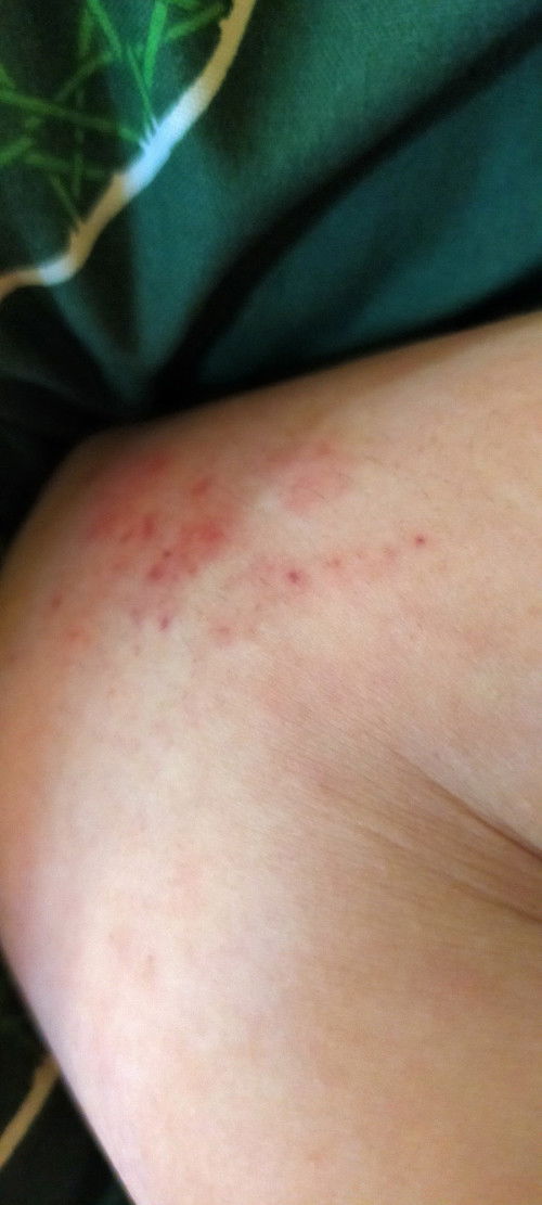 Ini diobati pake apa ya?