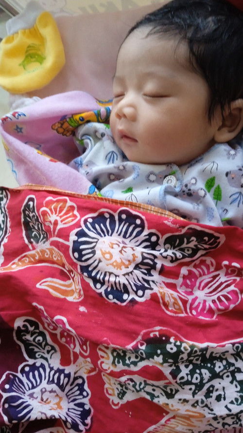 Mode SC di kehamilan 37 week