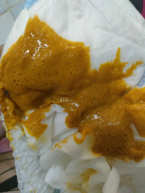 1เดือน21วัน อึเป็นฟองสมูทตี้เลยค่ะ